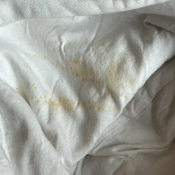 Adidas Women’s Cropped Hour Black White Varsity Stripe ST2925 Marks On Hood XS - Picture 5 of 5